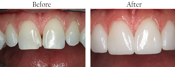Implant Dentist 01760
